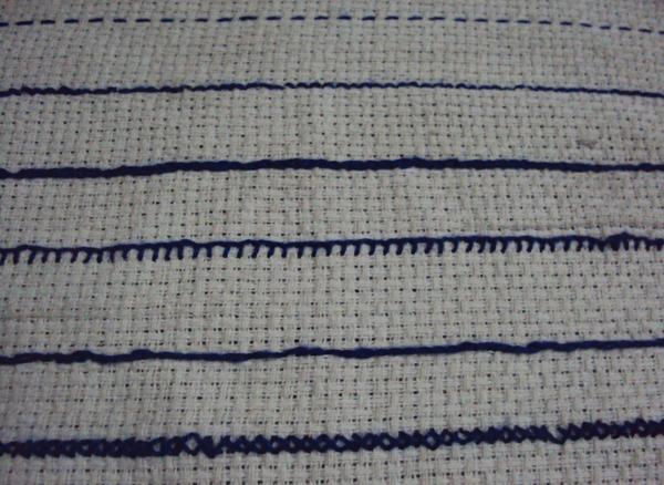 Stitches